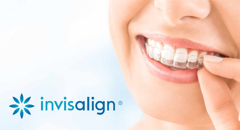 IS INVISALIGN FASTER THAN BRACES?